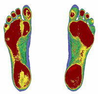 http://www.richardschiropractic.com/blog1/uploaded_images/footScan-794552.jpg